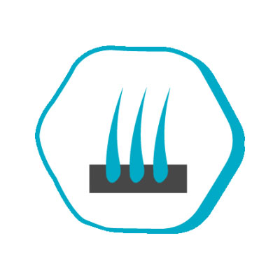 j3 j3 После операции по пересадке волос Istanbul Hair Россия Цены в Турции