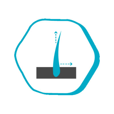 j7 j7 После операции по пересадке волос Istanbul Hair Россия Цены в Турции